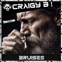 Bruises